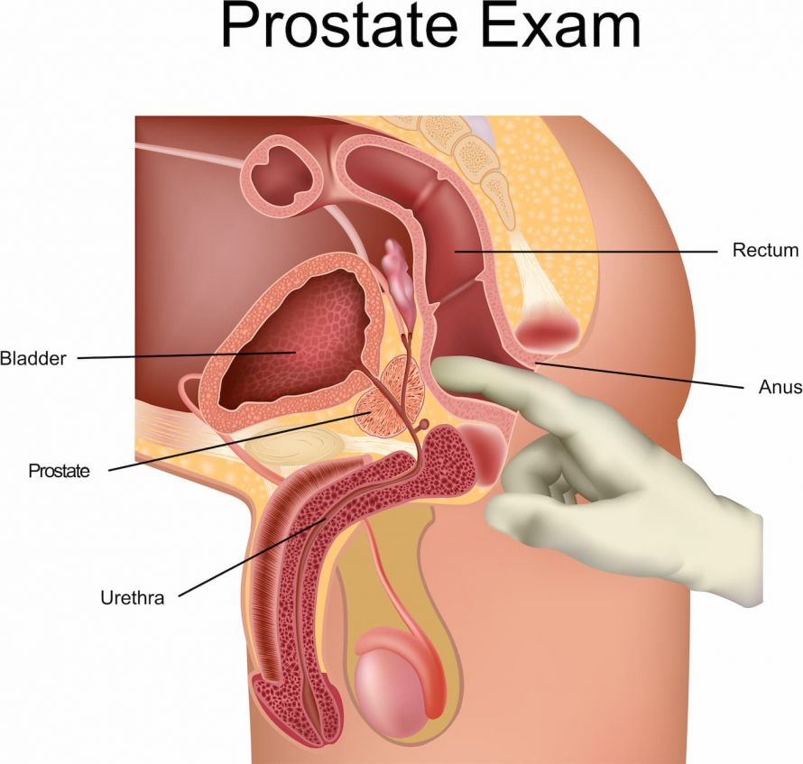 prostatakrebs behandlung